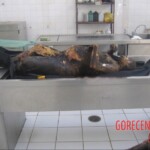 Burnt pregnant woman autopsy