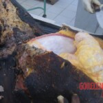 Burnt pregnant woman autopsy