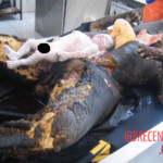 Autopsy of burnt pregnant woman