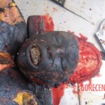 Burnt pregnant woman autopsy