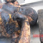 Burnt pregnant woman autopsy