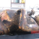 Burnt pregnant woman autopsy