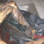 Burnt pregnant woman autopsy