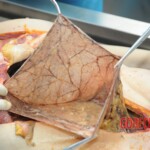 Autopsy of blonde woman