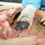 Autopsy of blonde woman