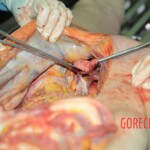 Autopsy of blonde woman