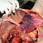 Autopsy of blonde woman