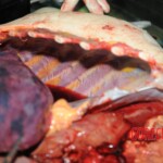 Autopsy of blonde woman