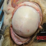 Autopsy of blonde woman