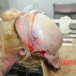 Autopsy of blonde woman