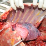 Autopsy of blonde woman