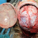 Autopsy of blonde woman