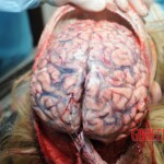 Autopsy of blonde woman