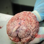 Autopsy of blonde woman