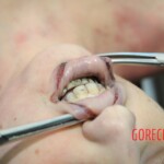 Autopsy of blonde woman