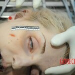 Autopsy of blonde woman