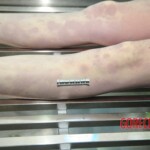 Autopsy of blonde woman