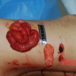 Badly stabbed woman in morgue