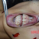 Badly stabbed woman in morgue