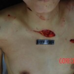 Badly stabbed woman in morgue