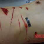 Badly stabbed woman in morgue