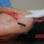 Badly stabbed woman in morgue