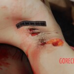 Badly stabbed woman in morgue