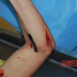 Badly stabbed woman in morgue