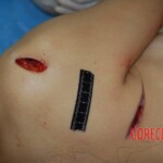 Badly stabbed woman in morgue