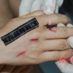 Badly stabbed woman in morgue