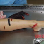 Badly stabbed woman in morgue