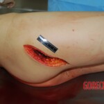 Badly stabbed woman in morgue