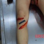 Badly stabbed woman in morgue