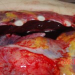 Autopsy on Chinese female