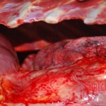 Autopsy on Chinese female