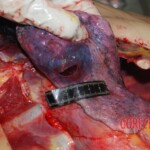 Autopsy on Chinese female