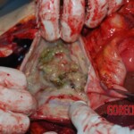 Autopsy on Chinese female