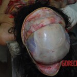 Autopsy on Chinese female