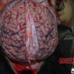 Autopsy on Chinese female