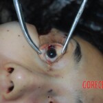 Badly stabbed woman in morgue