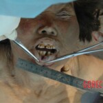 Bestially raped woman