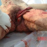 Bestially raped woman