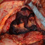 Bestially raped woman