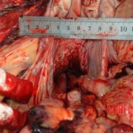 Bestially raped woman