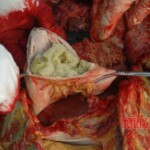 Bestially raped woman