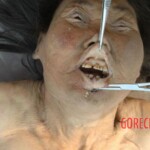 Bestially raped woman