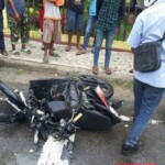 Amputated leg in accident