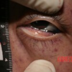 Murder of Chinese girl