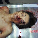 Examination of dead female