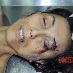 Examination of dead female